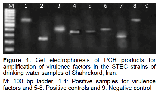 ejbio-Gel-electrophoresis