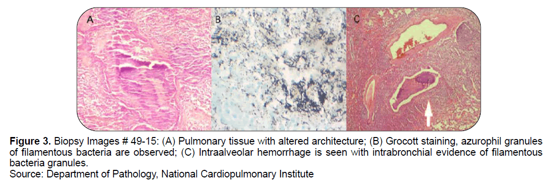 ejbio-Grocott-staining