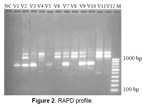 ejbio-RAPD-profile