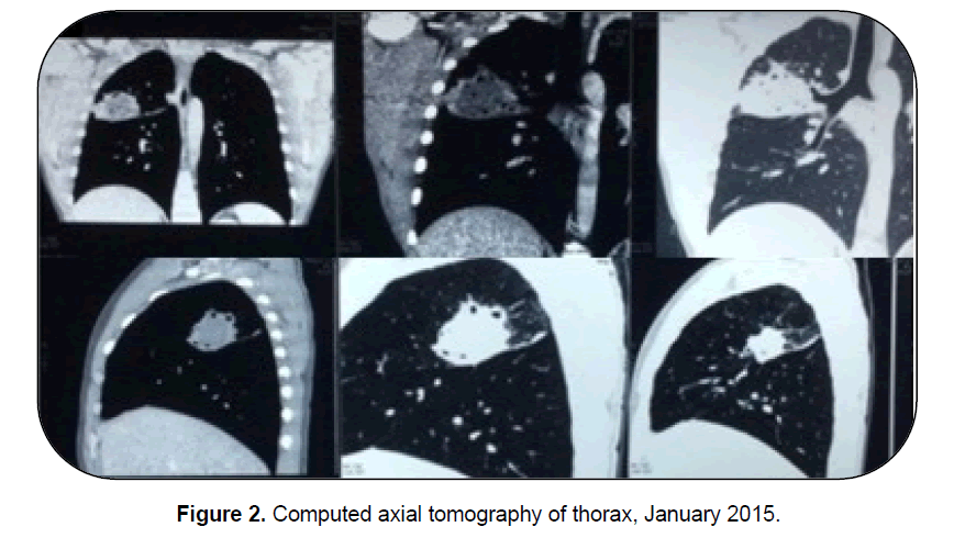 ejbio-axial-tomography