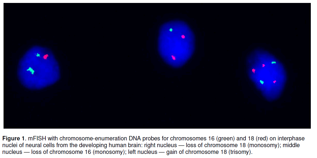 electronic-biology-chromosome-monosomy