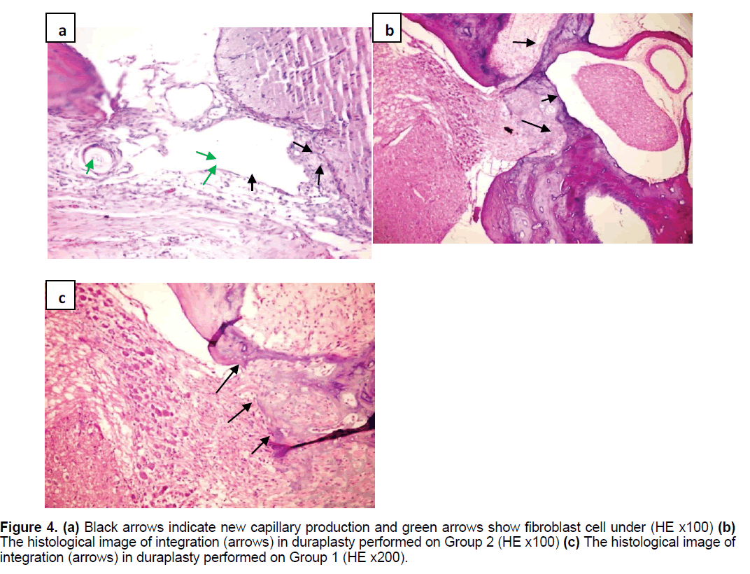 ejbio-fibroblast-cell