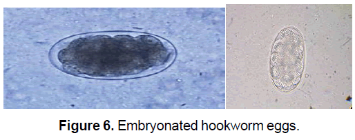 ejbio-hookworm-eggs